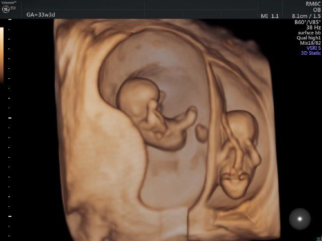 Raul Javier Banderas Pumarino-19