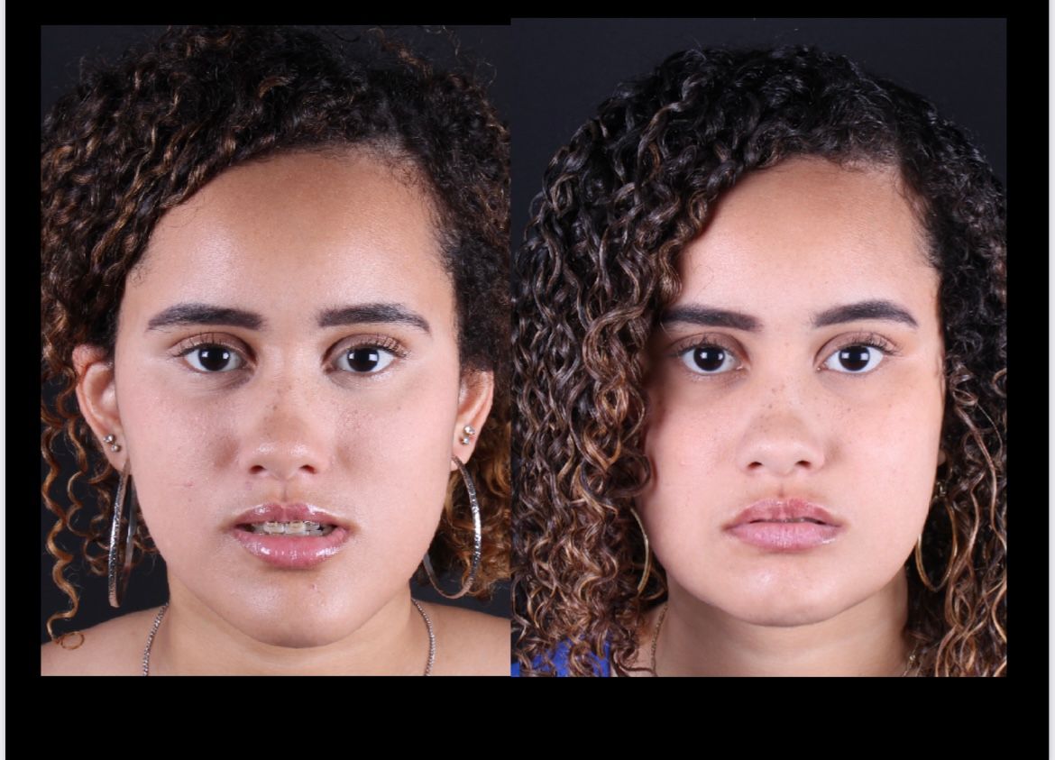 Frederico Carnevale-1