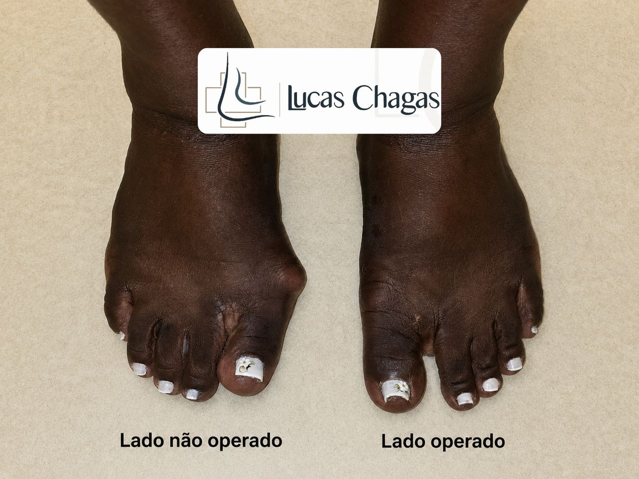 Lucas Chagas Gadelha-3