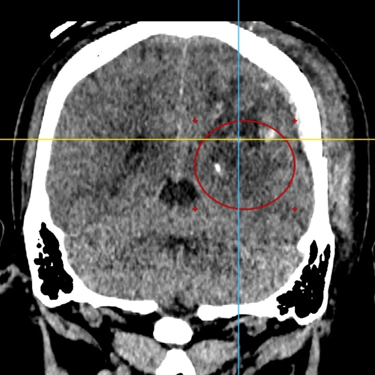 David Tafur Muñoz-1373