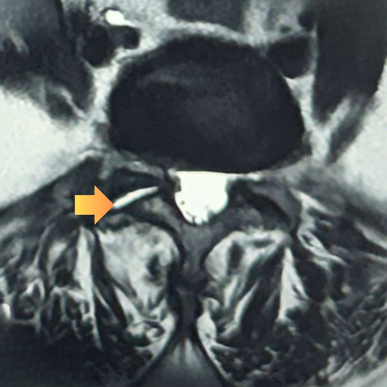 David Tafur Muñoz-2367