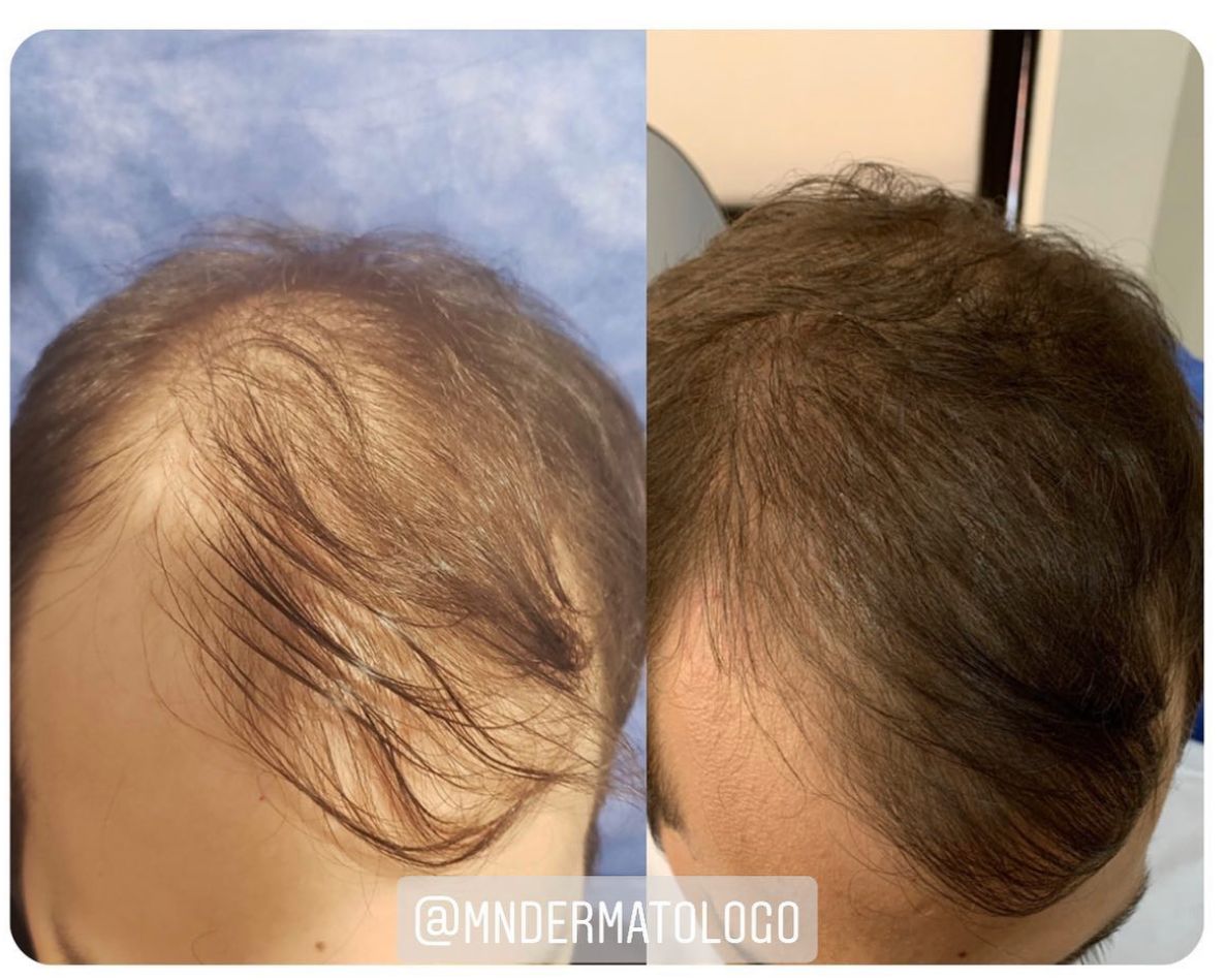 Mario Naranjo Otero-6