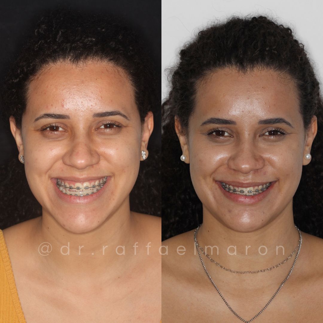 Raffael Maron Vieira De Noronha-16