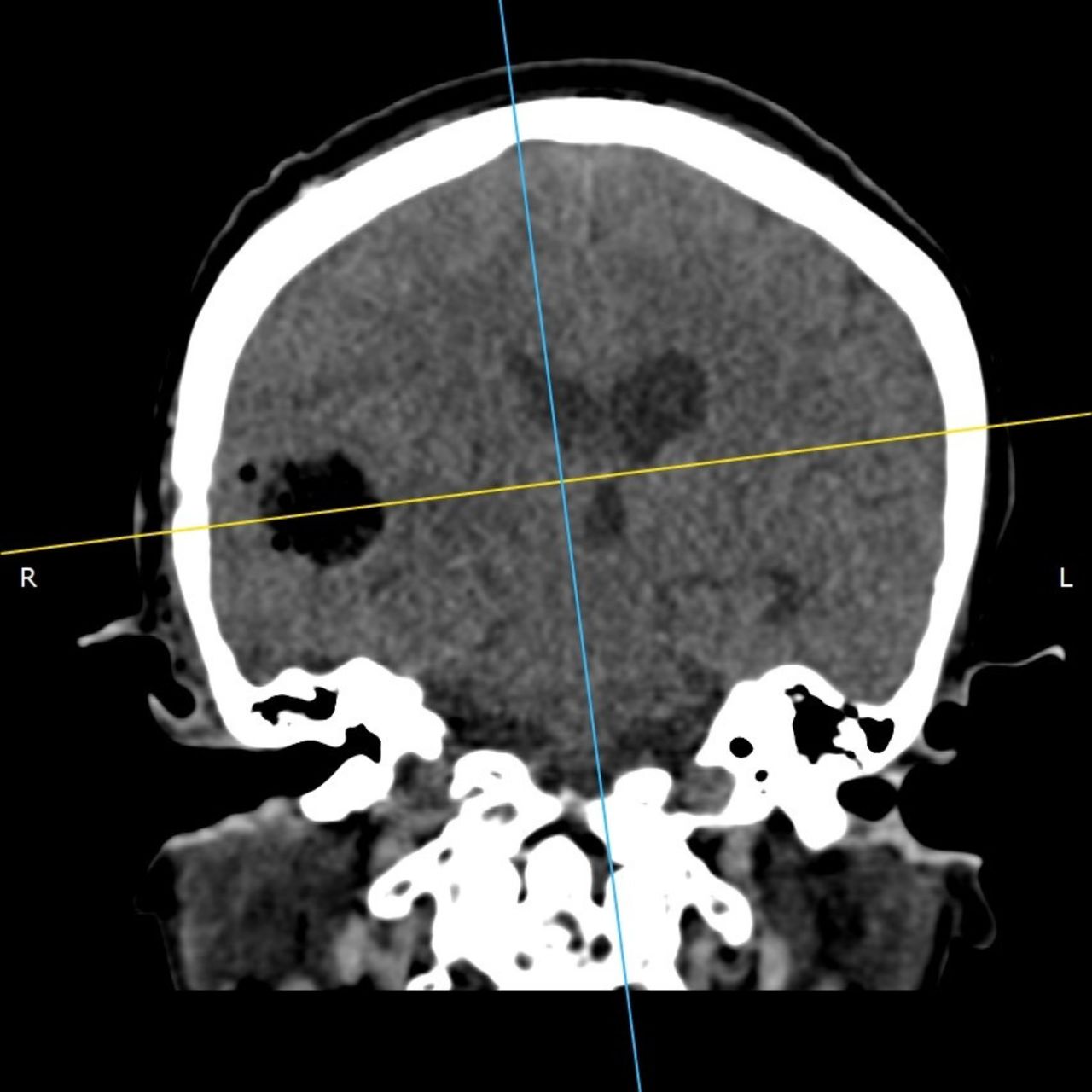 David Tafur Muñoz-1649