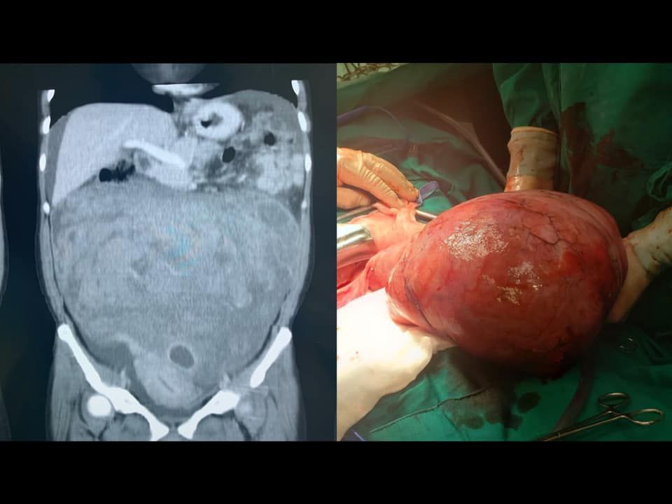 Albert Zevallos Cardenas-1