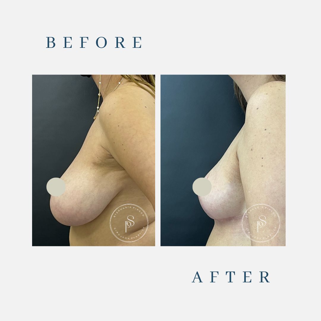 Stephanía Pinedo García-28