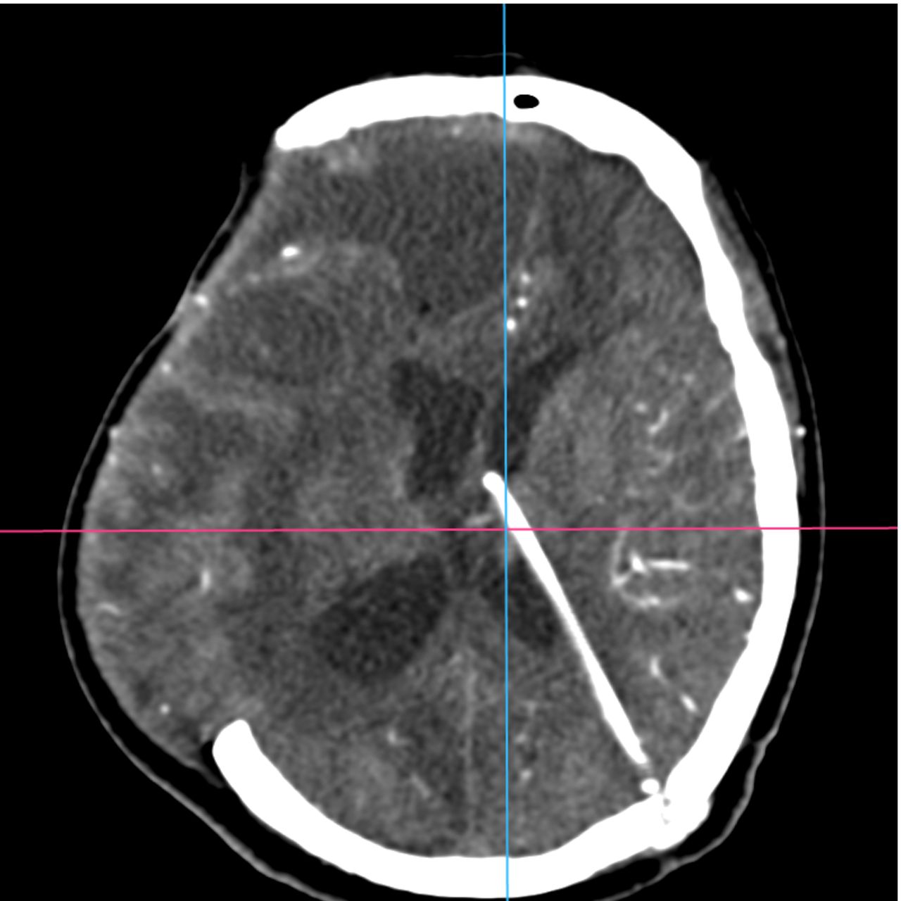 David Tafur Muñoz-1971