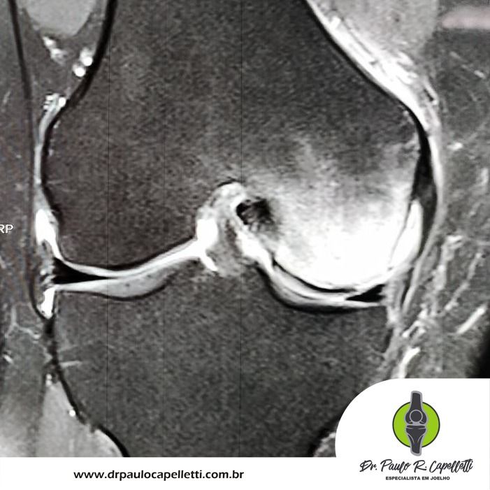 Paulo Roberto Capelletti-81