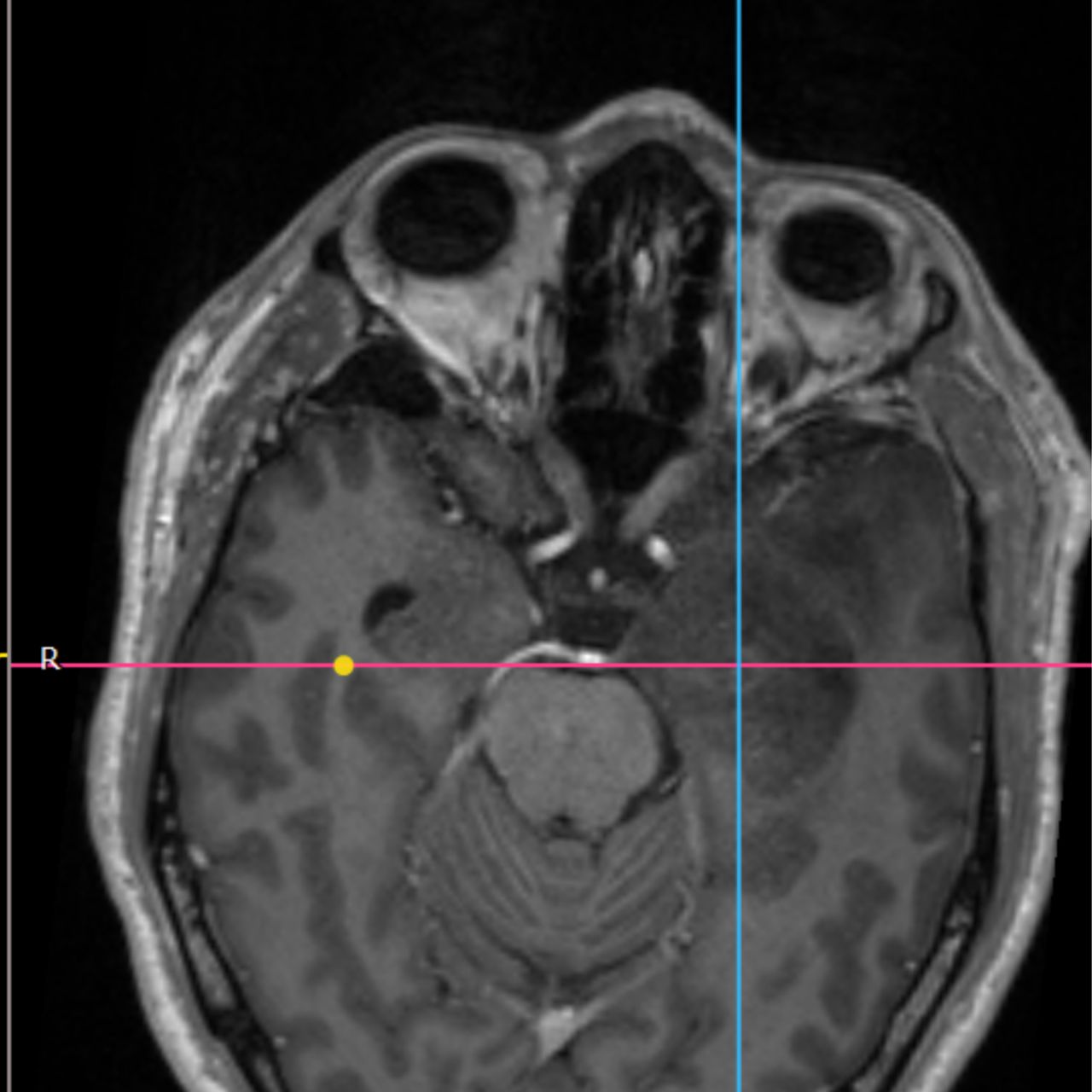 David Tafur Muñoz-1762