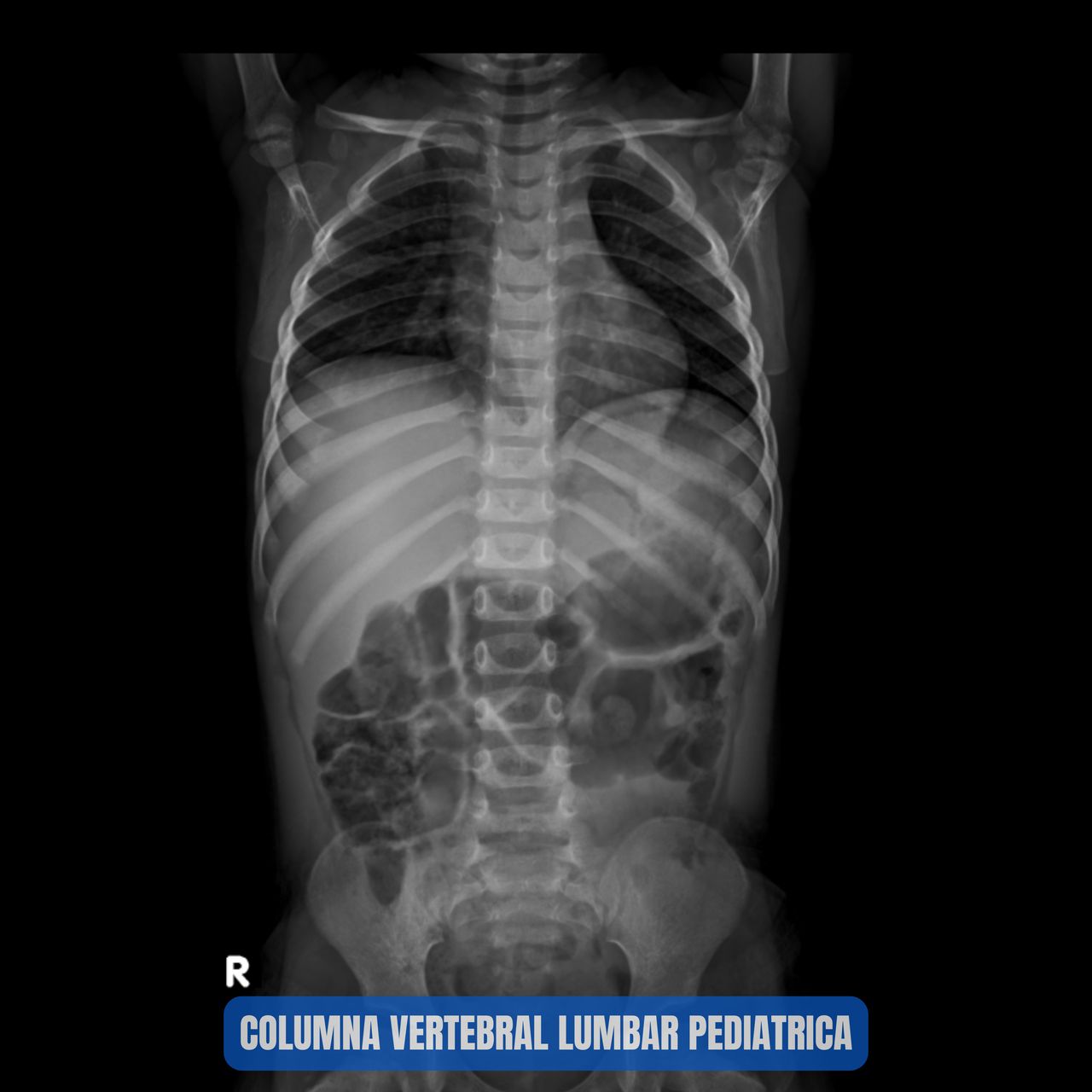 David Tafur Muñoz-1030