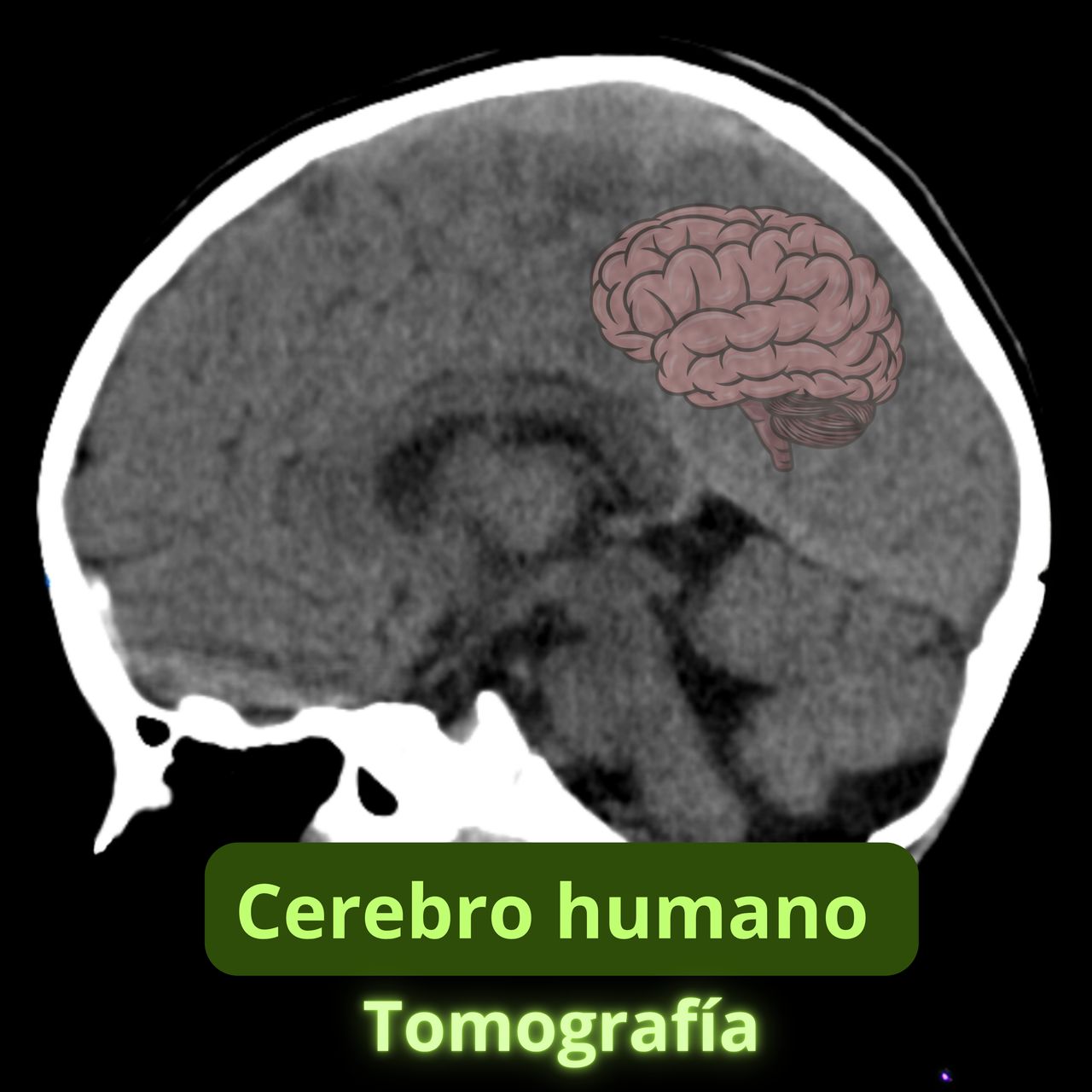 David Tafur Muñoz-1356