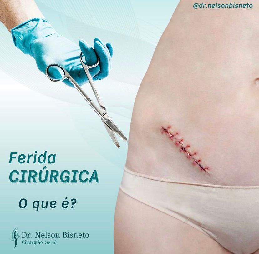 Nelson Bisneto-54