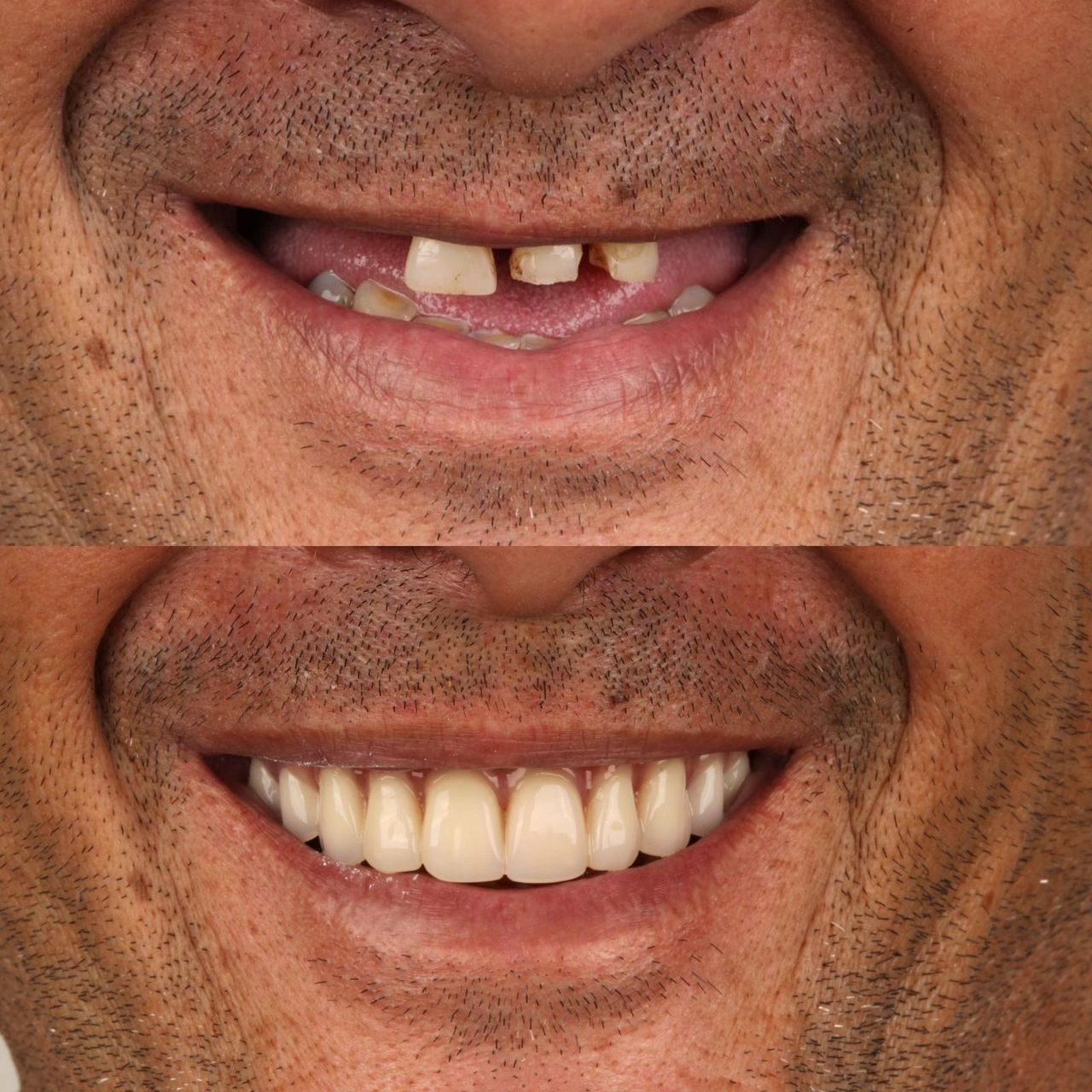 Gabriel Lucio Calazans Duarte-8