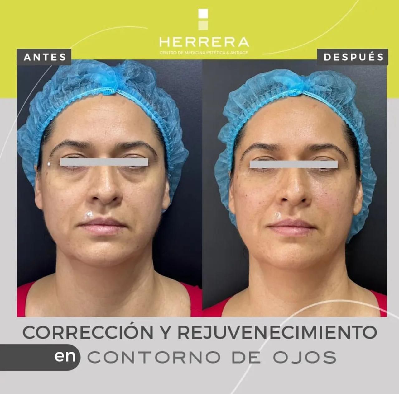 Andrea Alonso Herrera-12