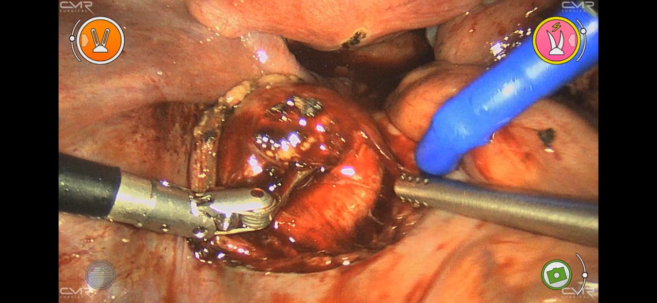 Adalberto Cesario Pereira Junior-60