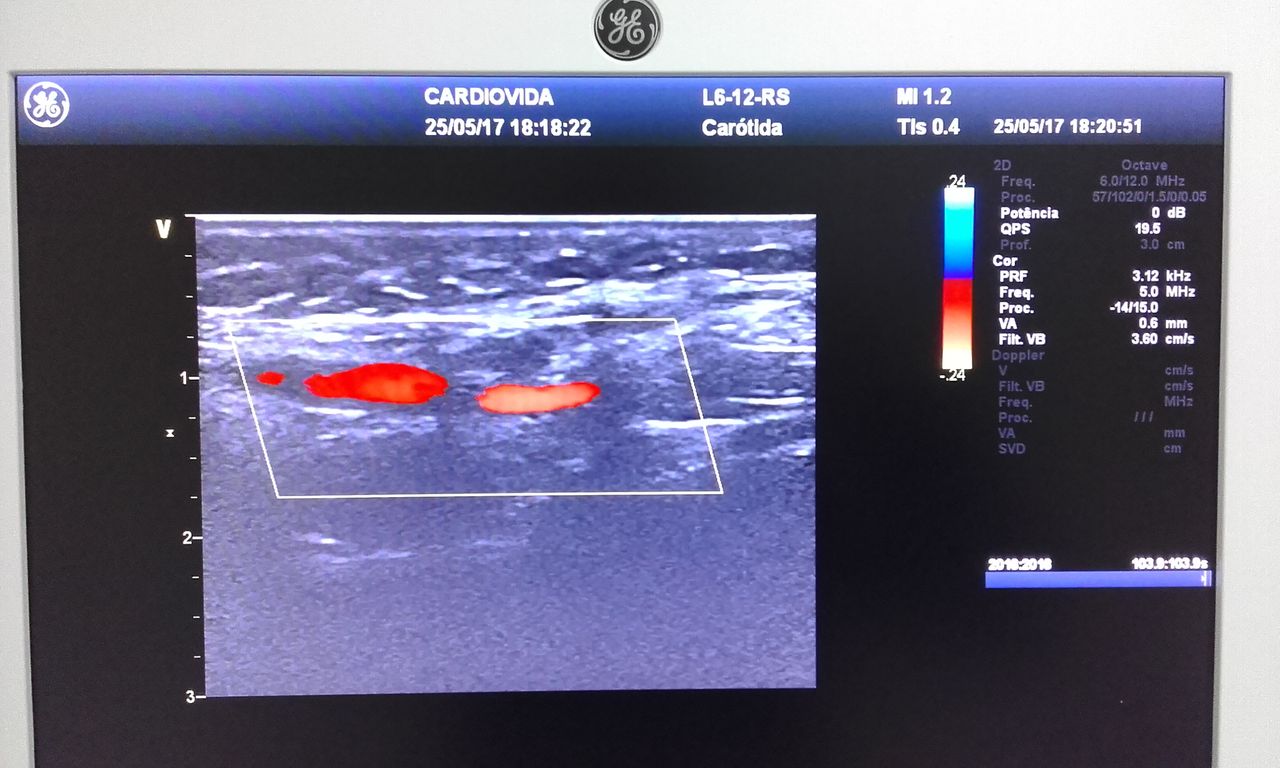 Haroldo Gomes Nascimento-4