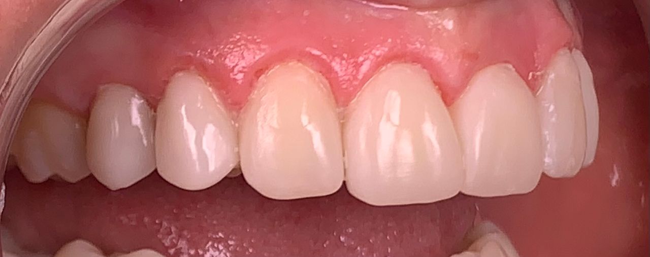 Ricardo Nuñez  Acuña-0