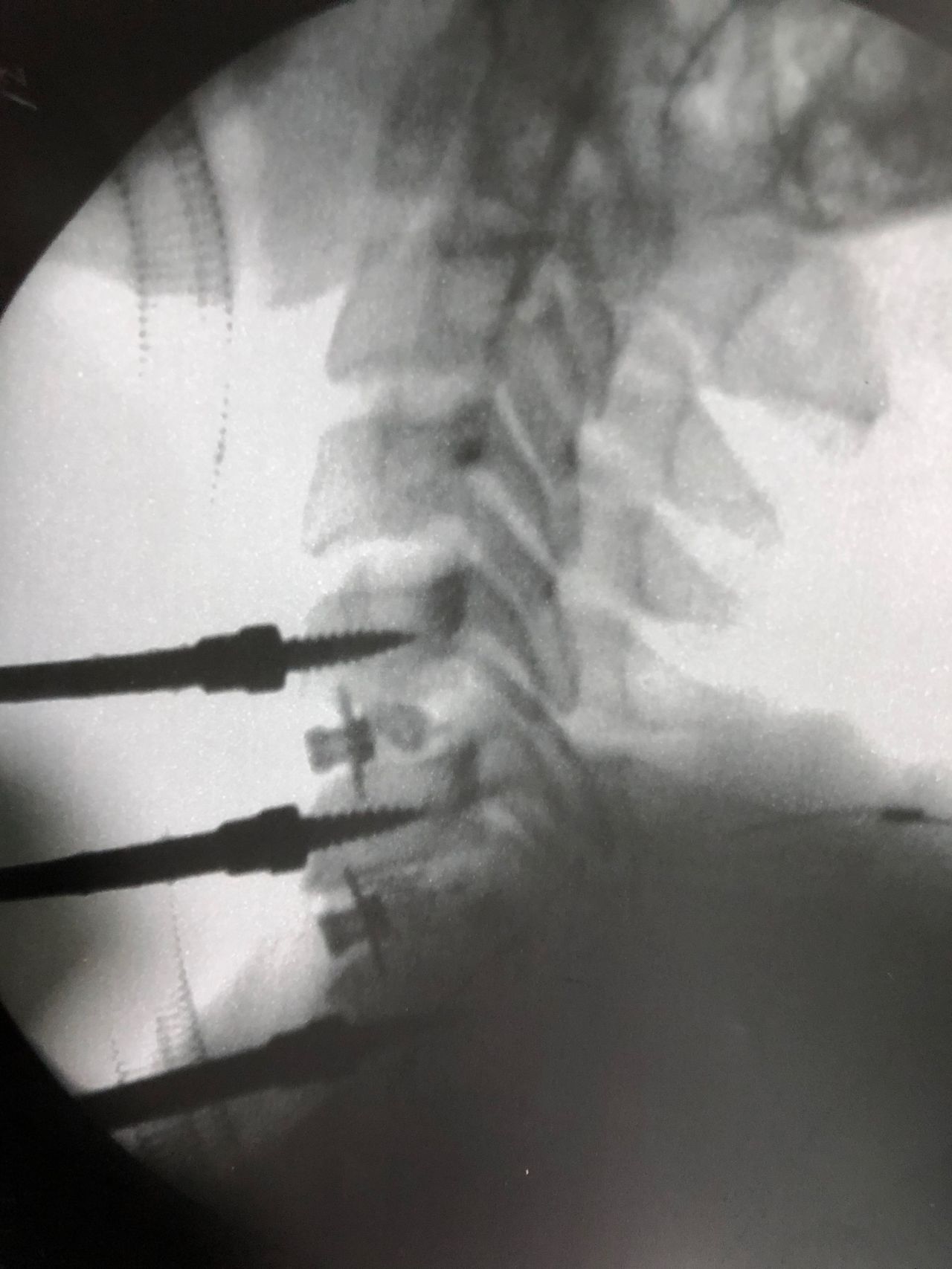 José Lopes Sousa Filho-23