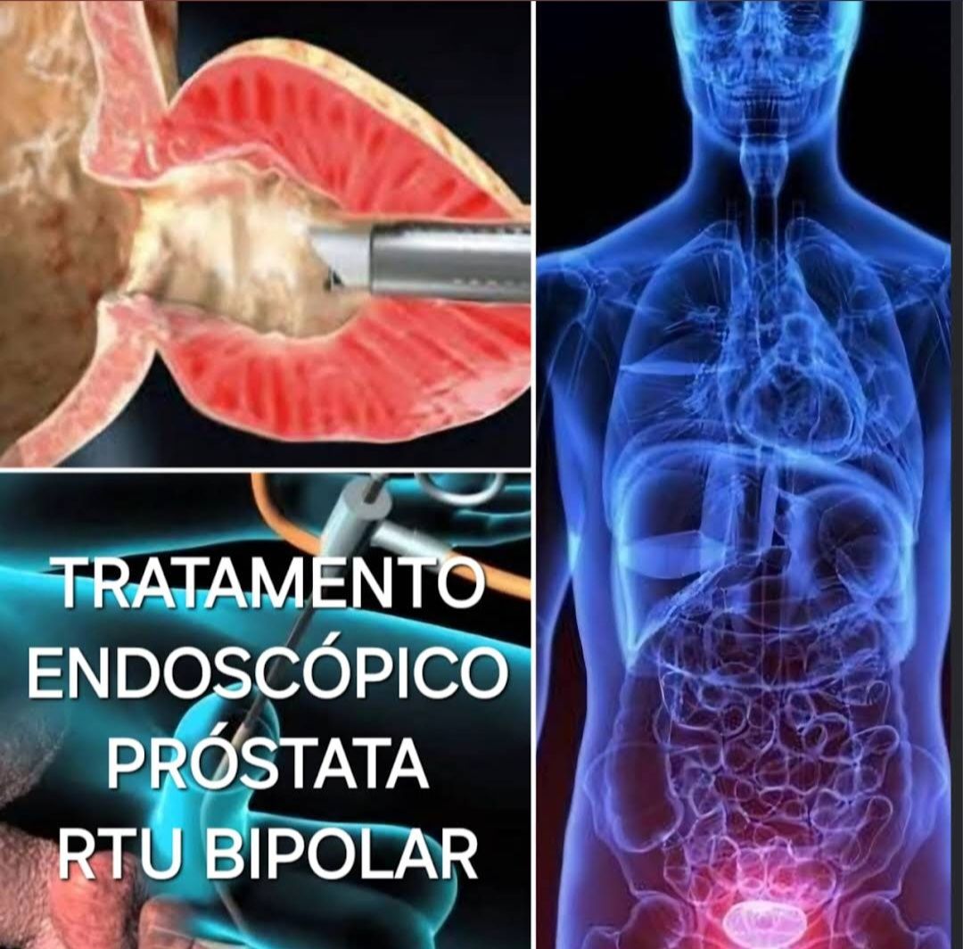 Robison José Manfredi-16