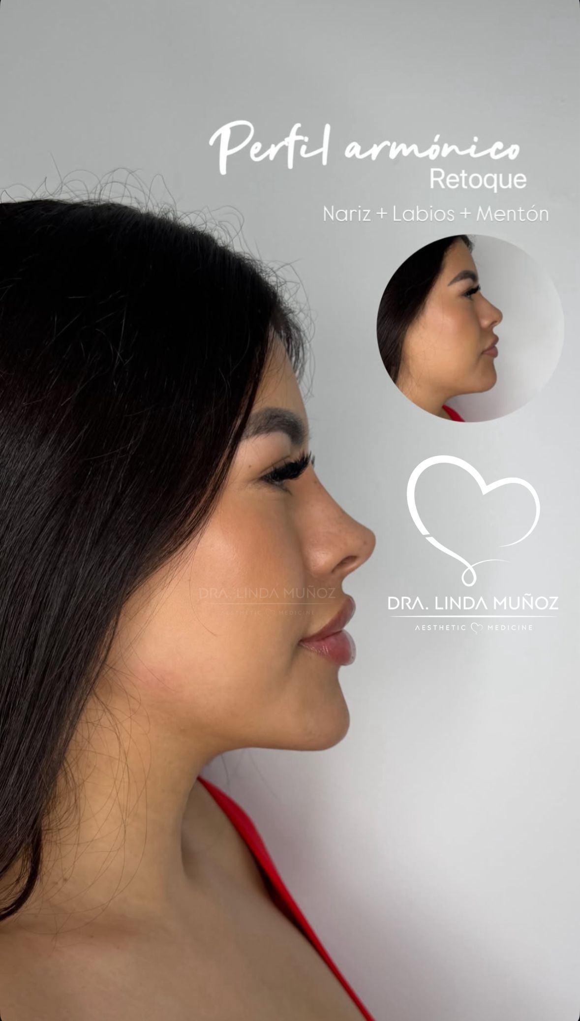 Linda Muñoz-52