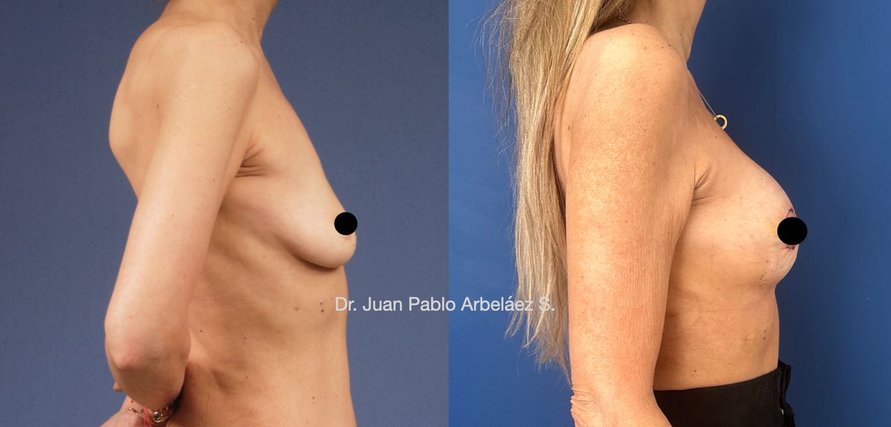 Juan Pablo Arbeláez Sierra-28