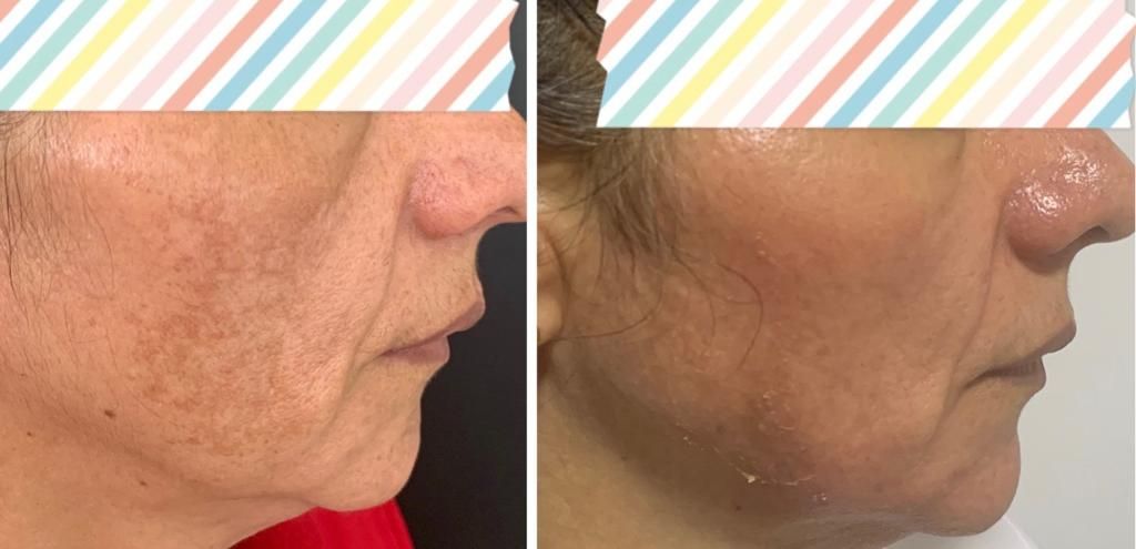 Maria Gisela Angel Losada-32