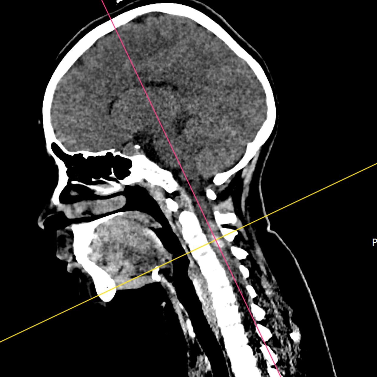David Tafur Muñoz-1643