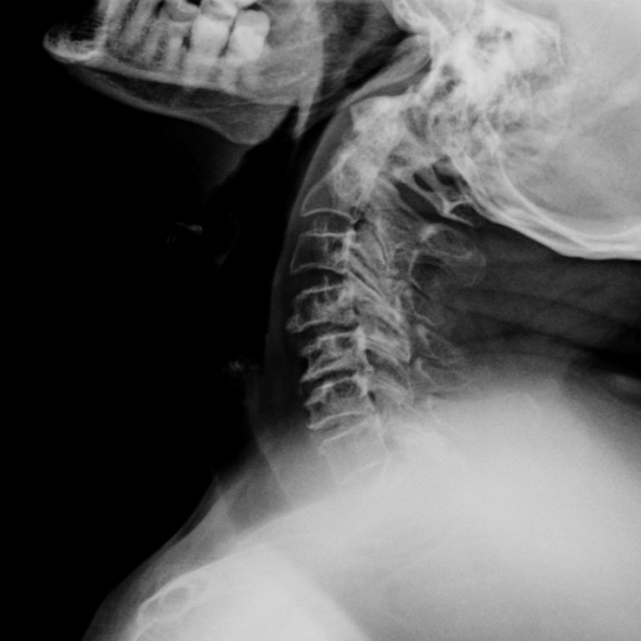 David Tafur Muñoz-1729