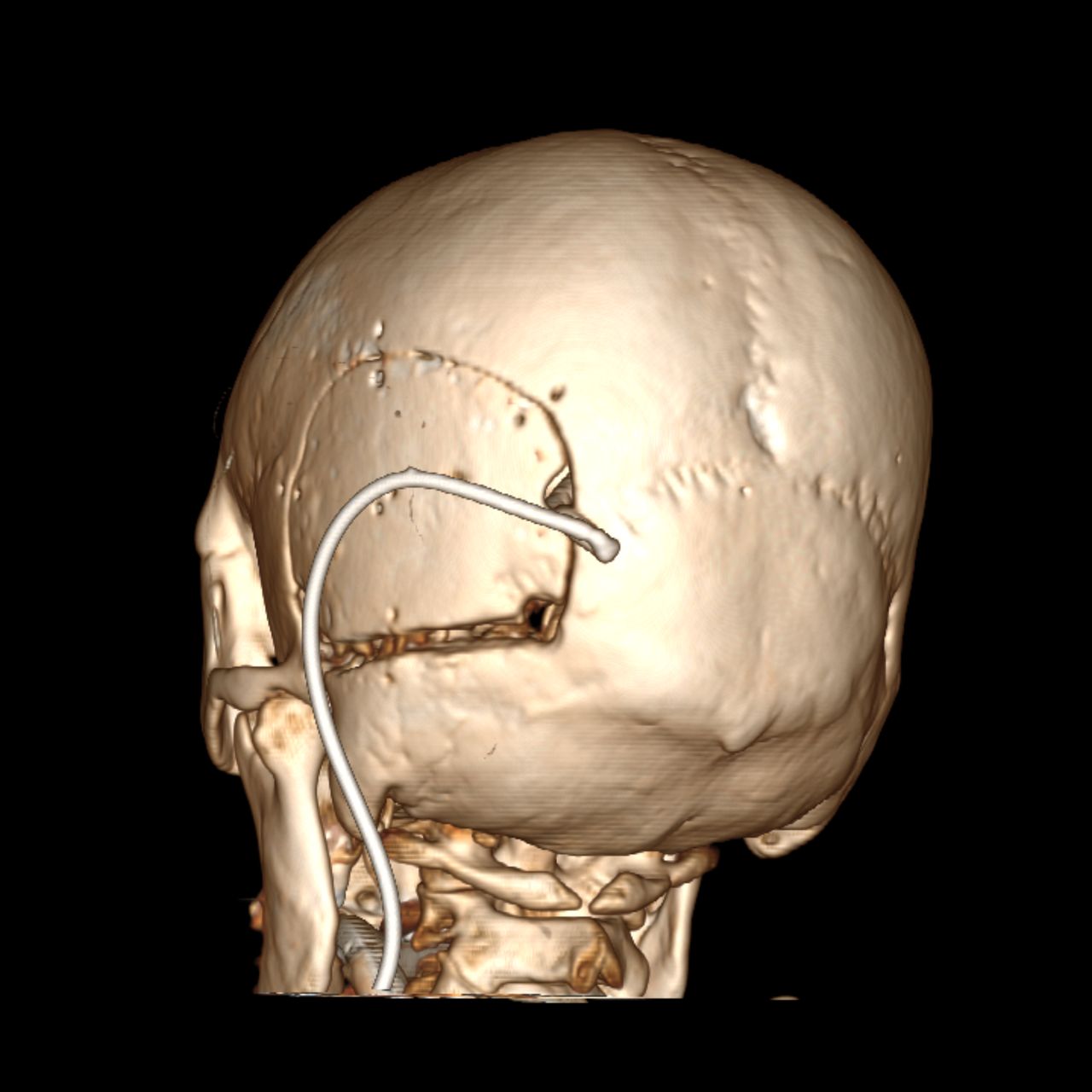 David Tafur Muñoz-1298