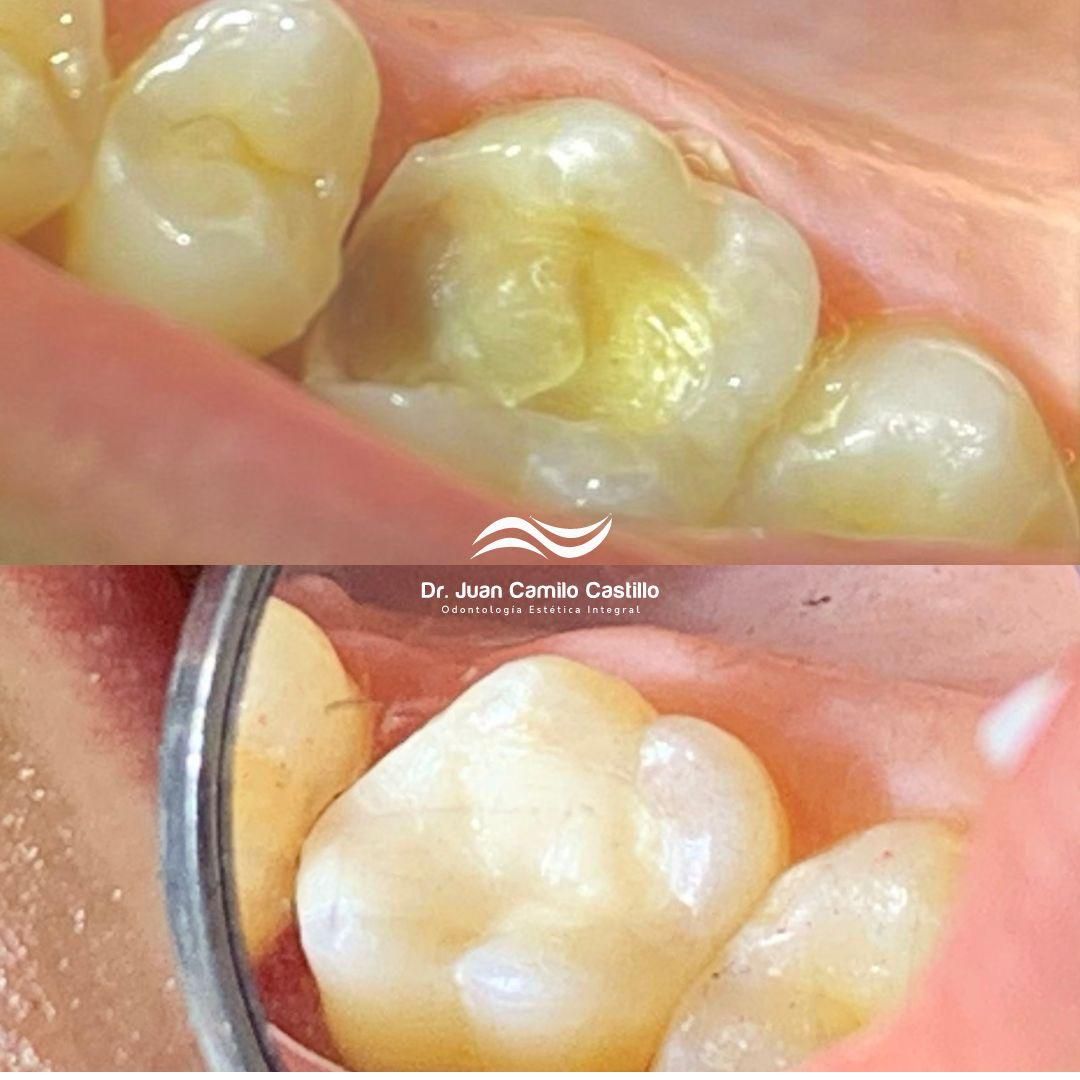 Juan Camilo Castillo-6