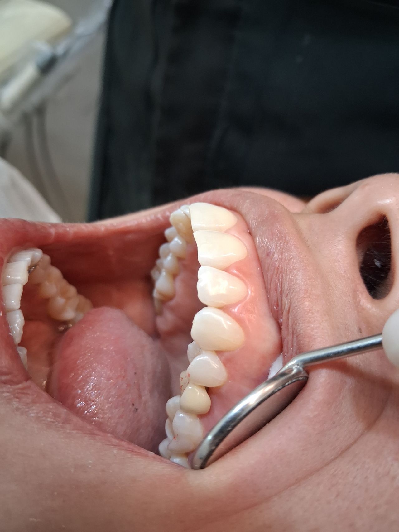 Jonatan Franco Ferreira-1