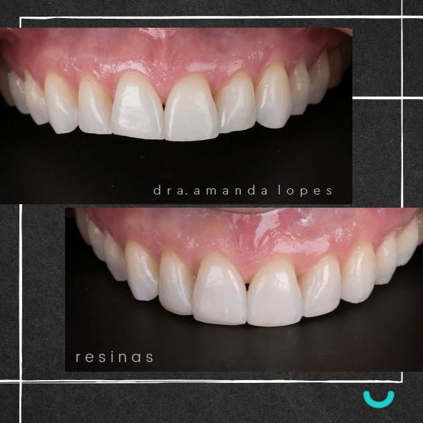Amanda Lopes-37