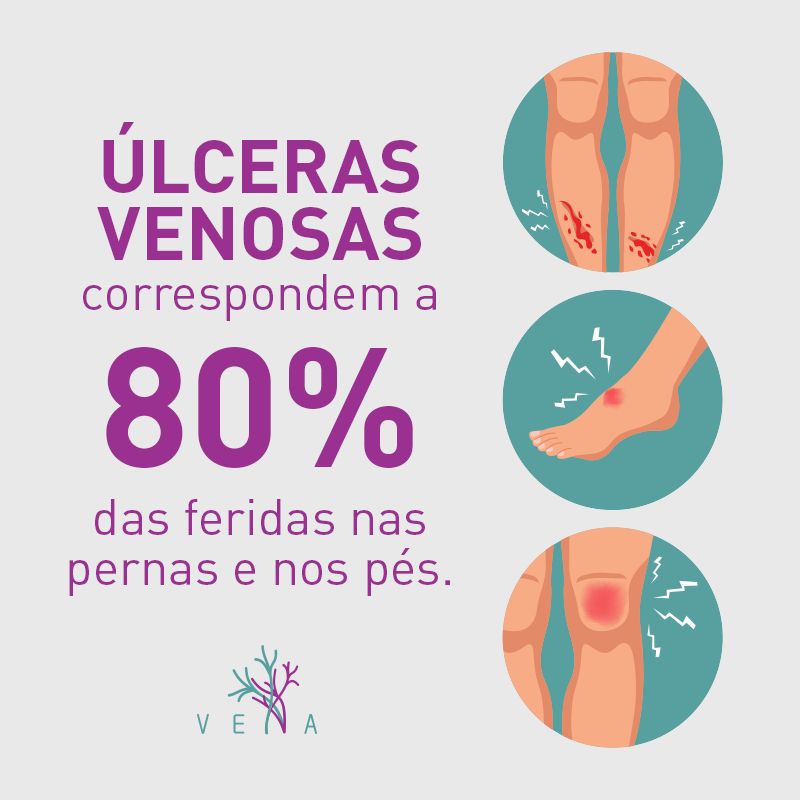 Roberto Scheibler Heck-11