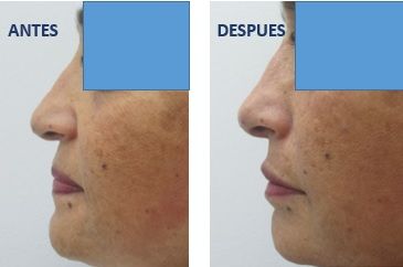 Ljubica Malinarich Sarabia-5