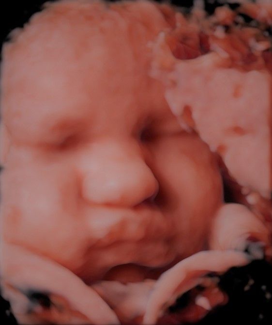 Charles Schwantz De Lima-19