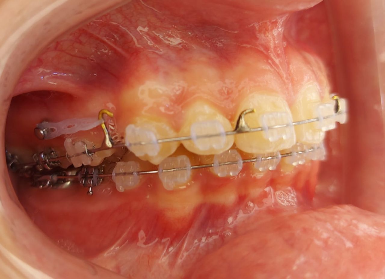 Camila De Loyola E Silva Avellar Fonseca-13