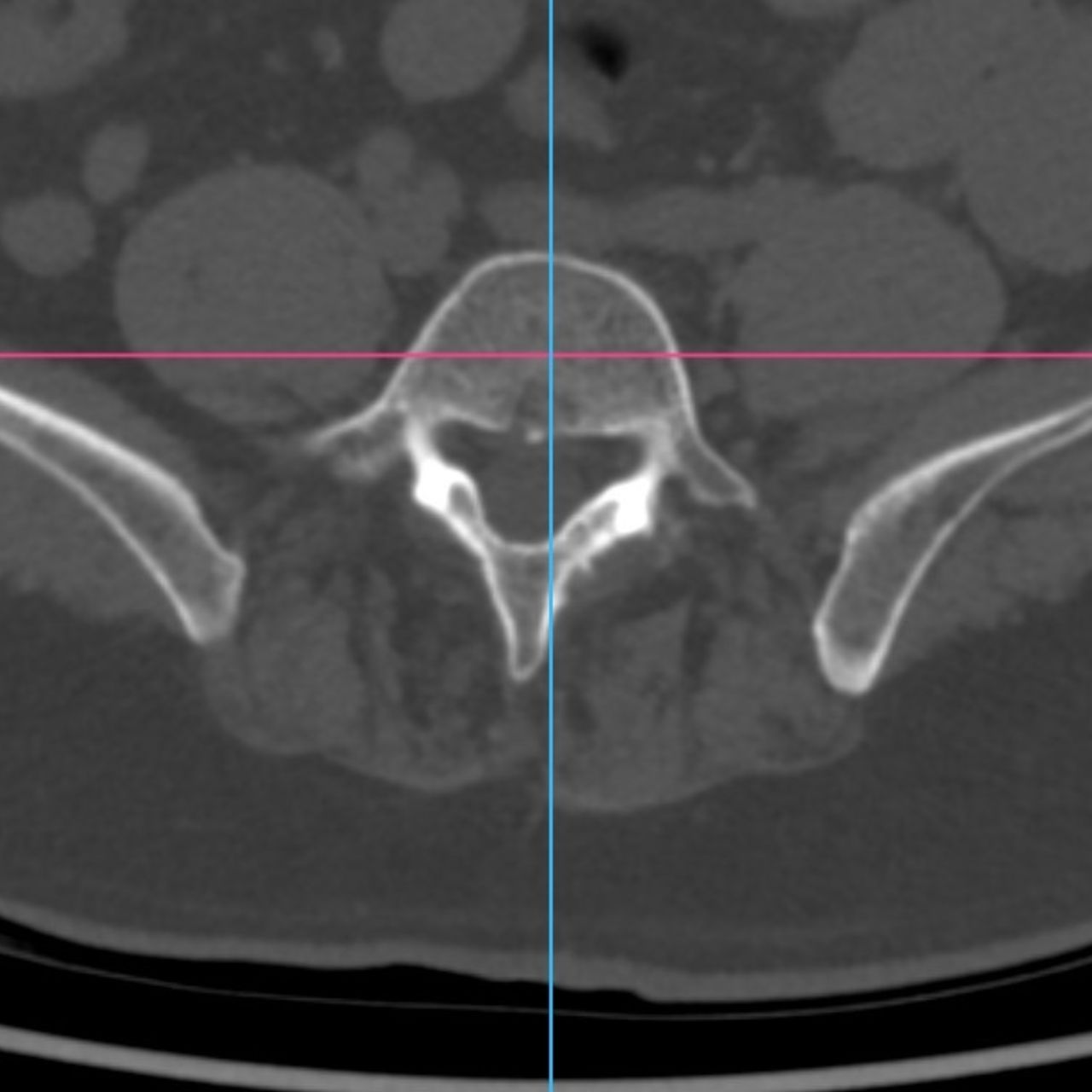 David Tafur Muñoz-2017