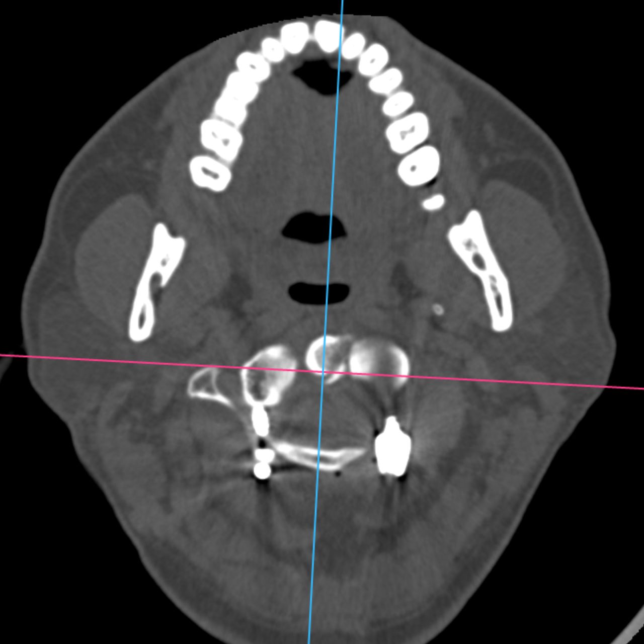 David Tafur Muñoz-1975