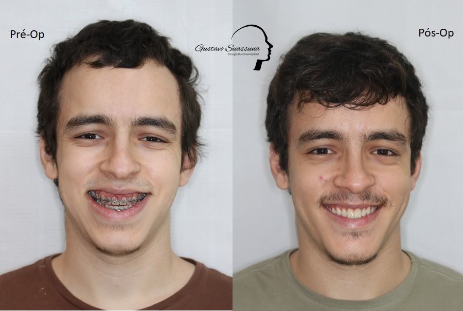 Gustavo Suassuna-25