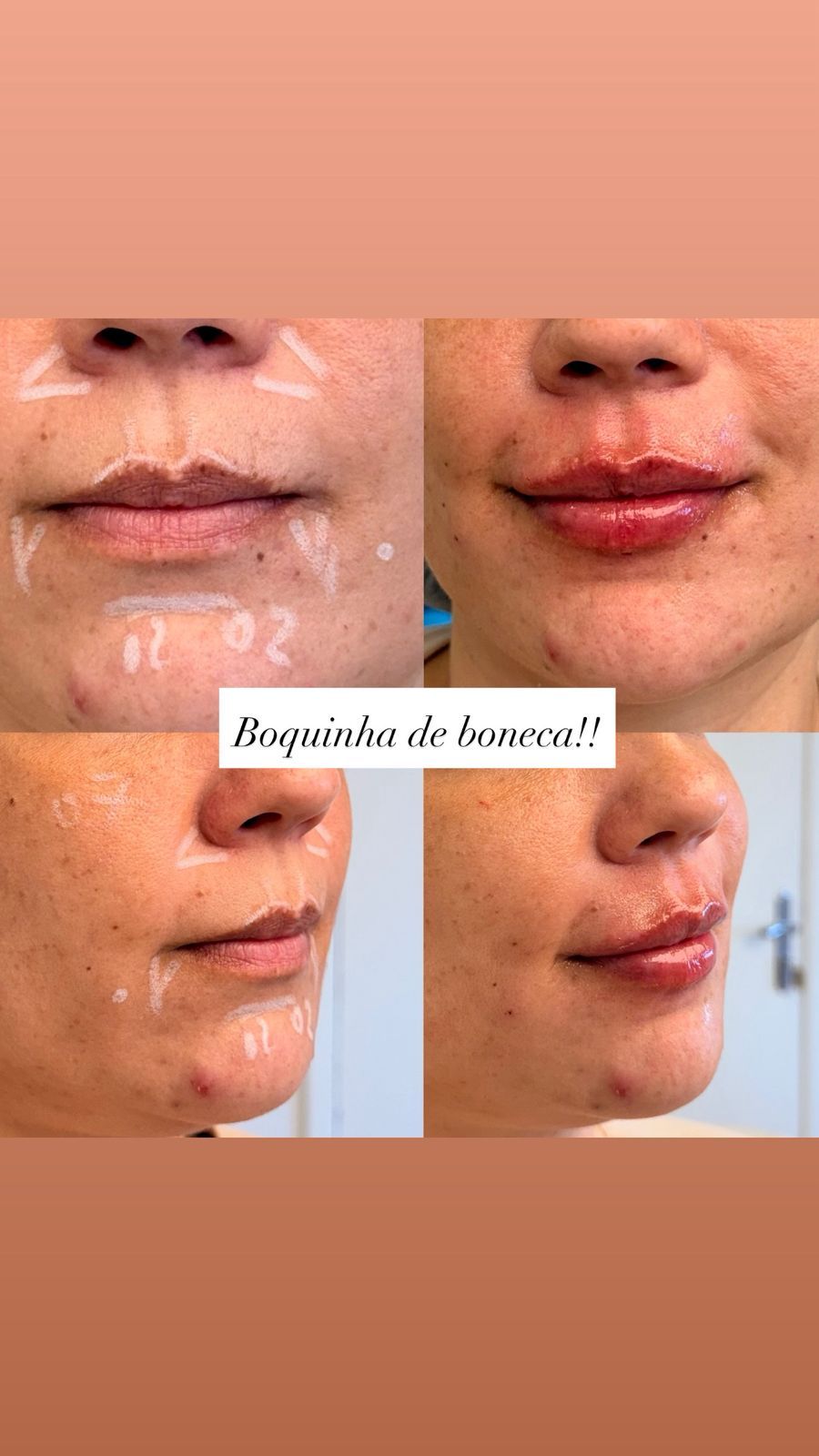 Telma Viana Martins-0