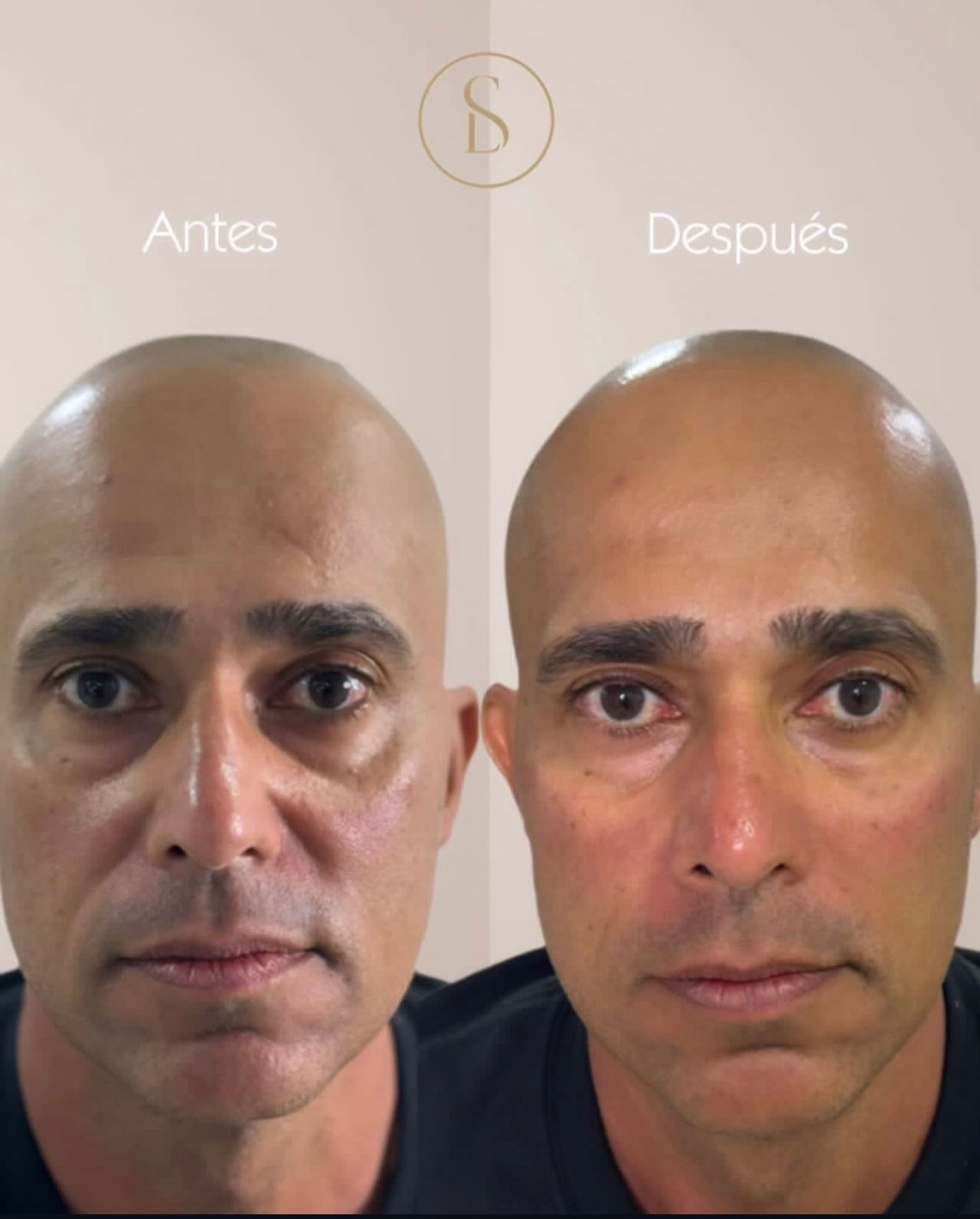 Liliana Spitaletta-1