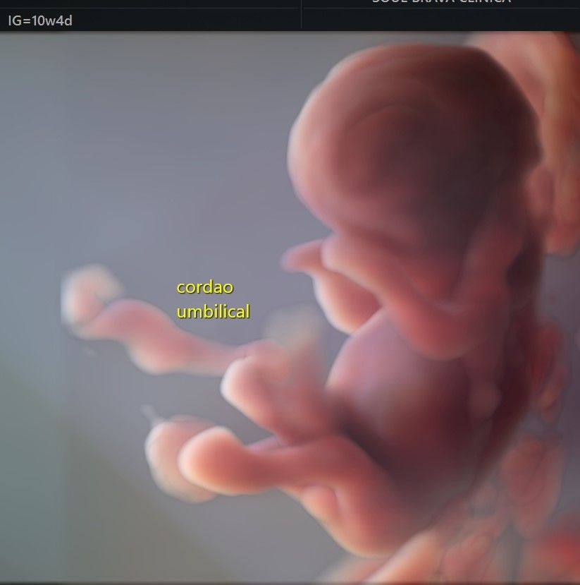 Charles Schwantz De Lima-6