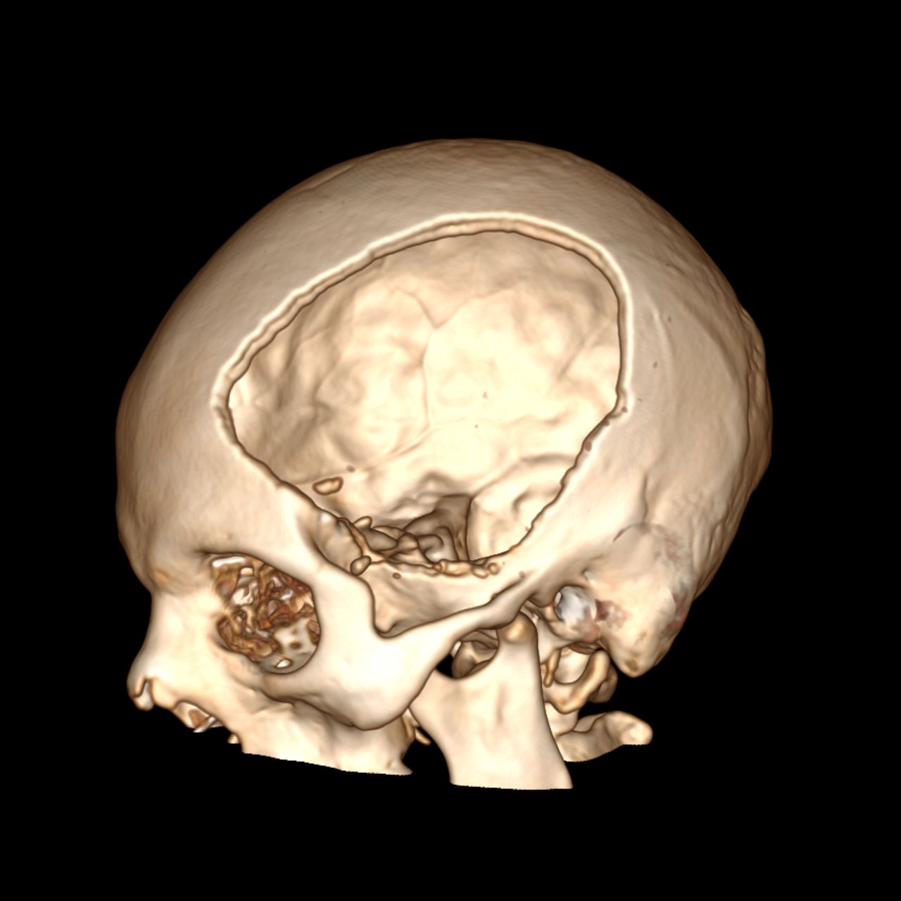 David Tafur Muñoz-1303