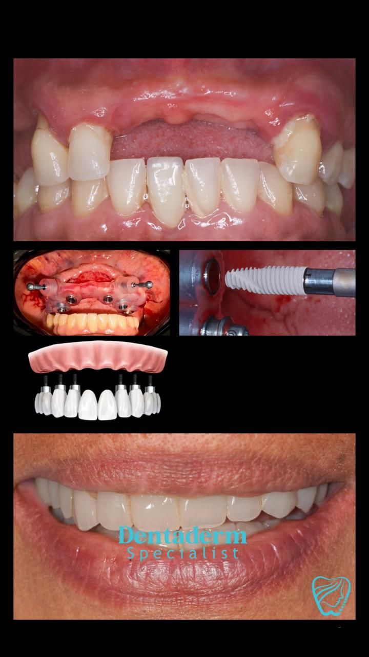 Alejandro Palacio Holguín-1