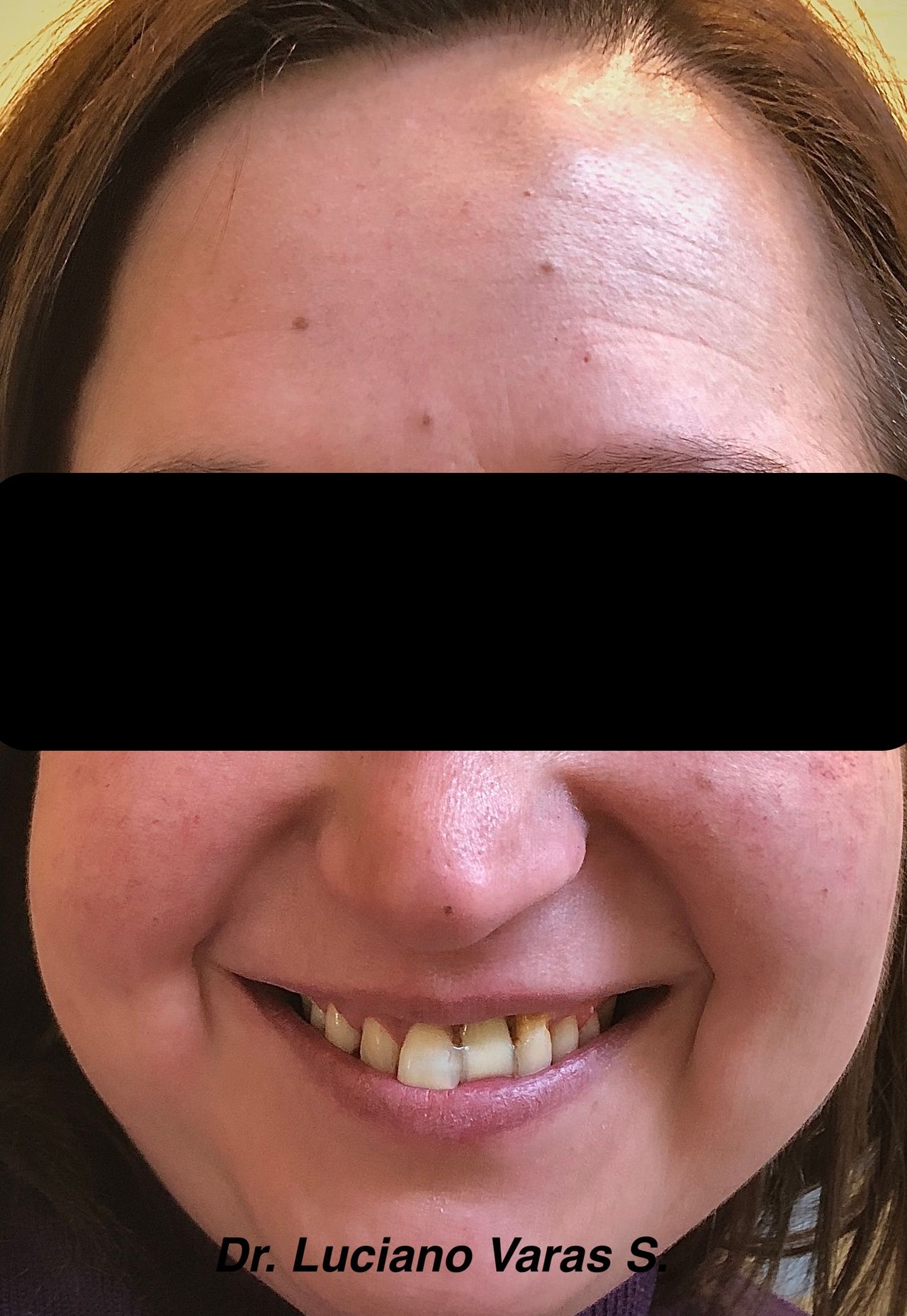 Luciano Varas Salinas-14