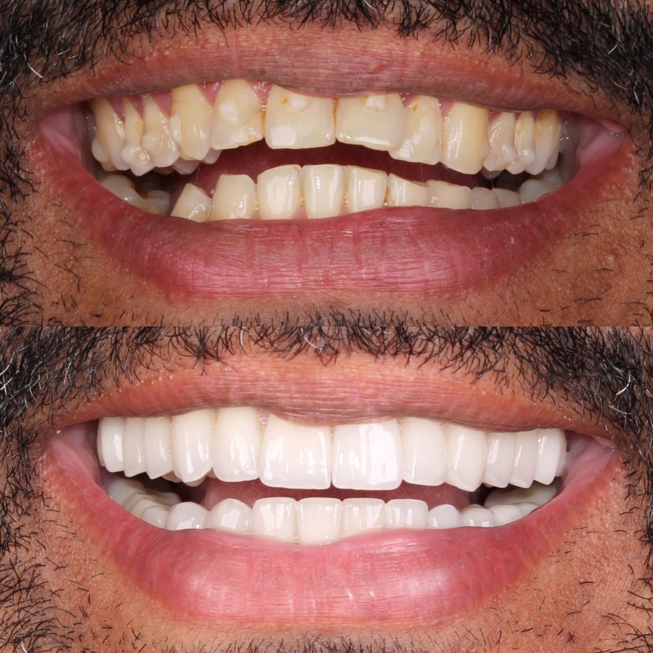 Caroline Benedeti-11