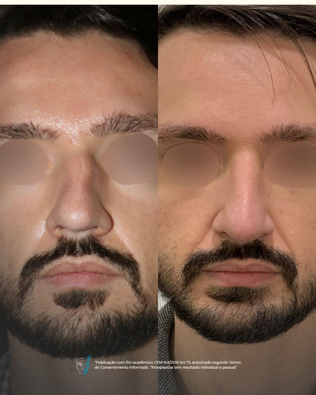 Hugo Cardoso De Oliveira-8