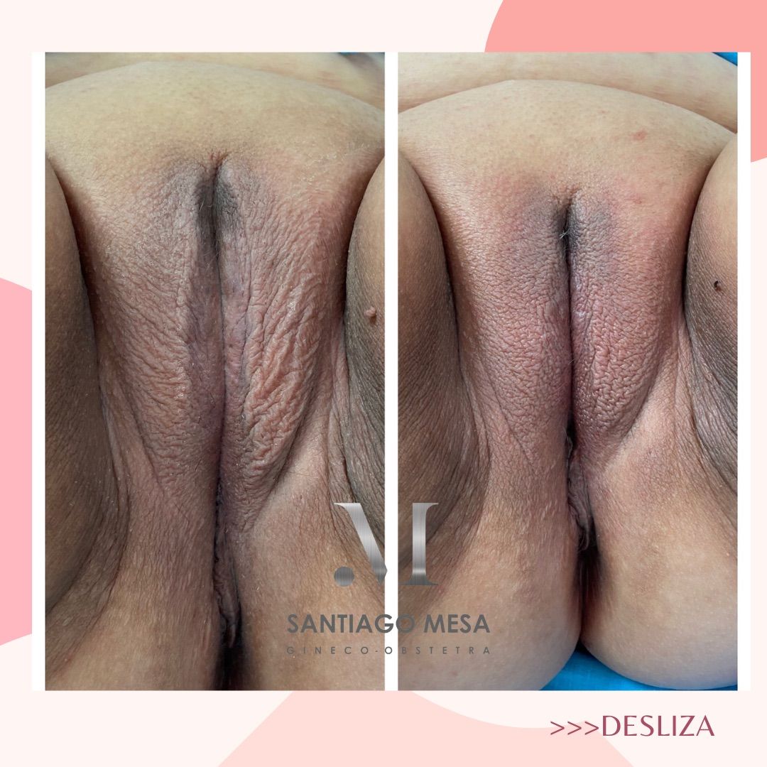 Mario Santiago Mesa Espinel-4