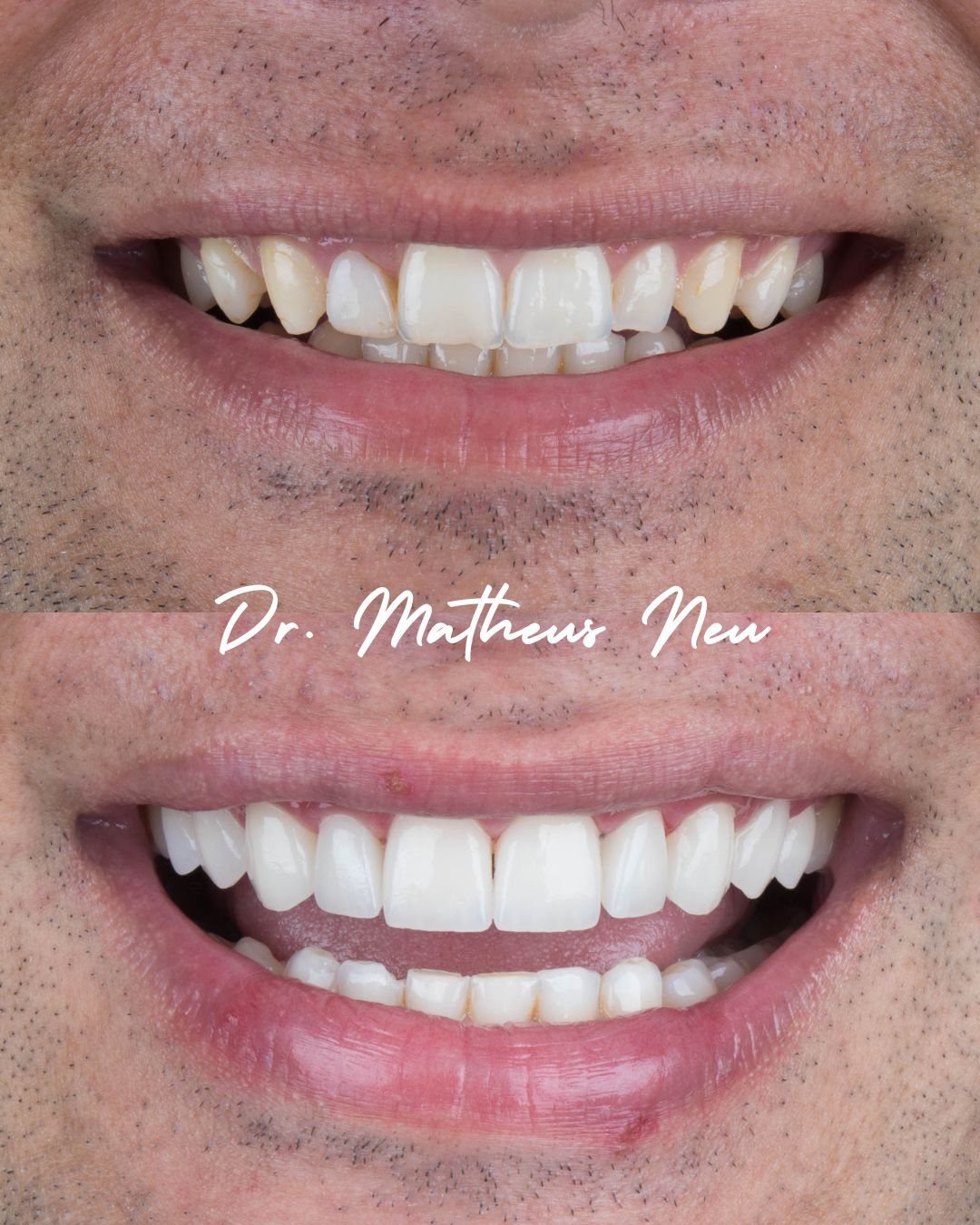 Matheus Da Silveira Neu-12