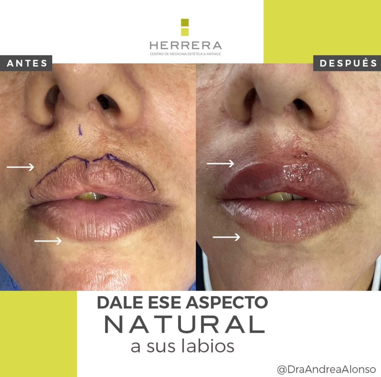 Andrea Alonso Herrera-15